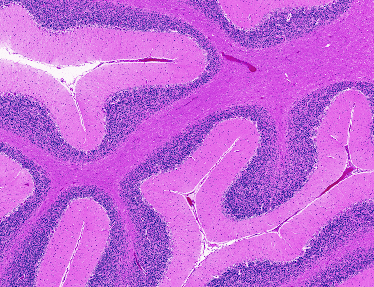 The Impact of SARS-CoV-2 on the Brain: It Is All in Your Head