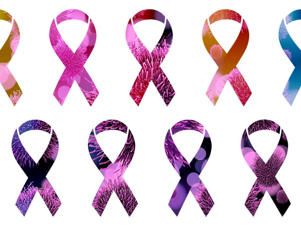 Diagnosing cancer by microbial signatures