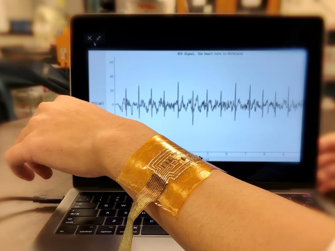 E-skin: the future of sustainable & recyclable wearable electronics